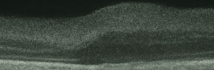 SPIM – Mikroskop pro kutily