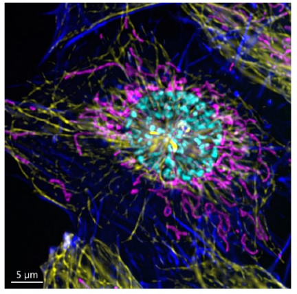 Mammalian cell