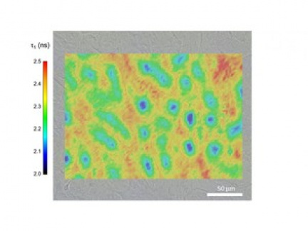 FLIM (Fluorescence Lifetime Imaging Microscopy)